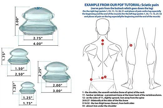 Silicone Anti Cellulite Suction Cup Massage Sets